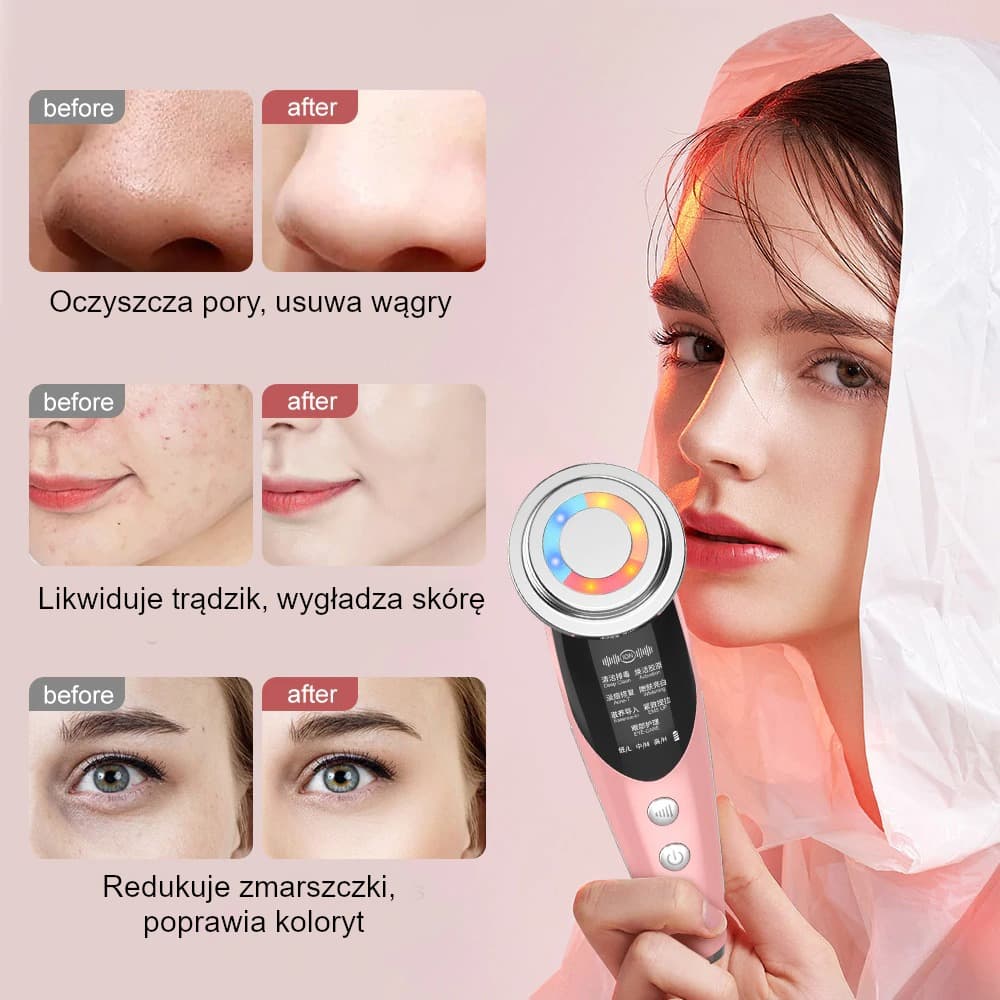 Mezoterapia bezigłowa EMSFACE™ 